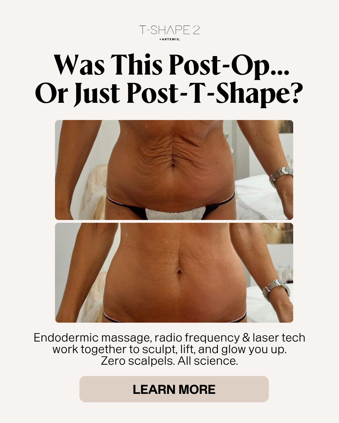 Abdomen firming before and after